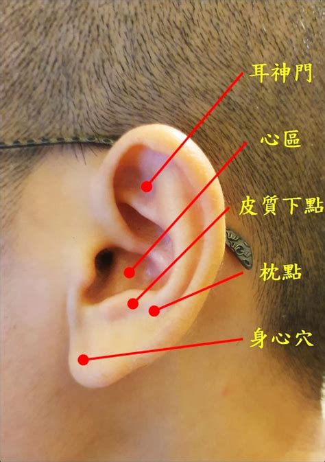 耳貼是什麼|耳朵是人體的縮影》用耳穴治療萬名病人，第一名家醫。